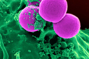 Bacterias